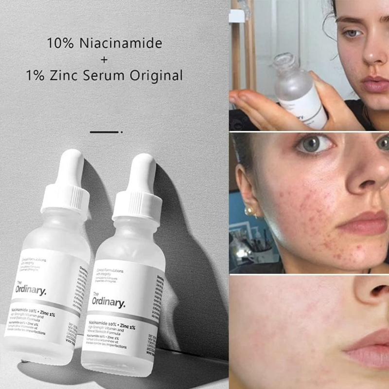 The Ordinary Niacinamide 10% + - Skincare La Roche Posay avaliação e preço