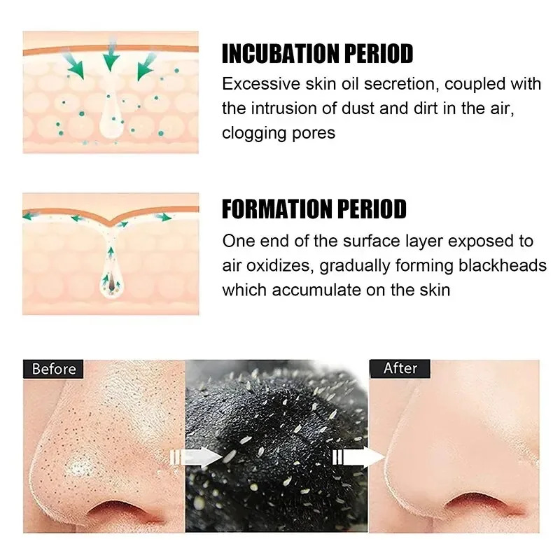 10/150PCS Máscara Removedora d - Skincare Finally Found You avaliação e preço